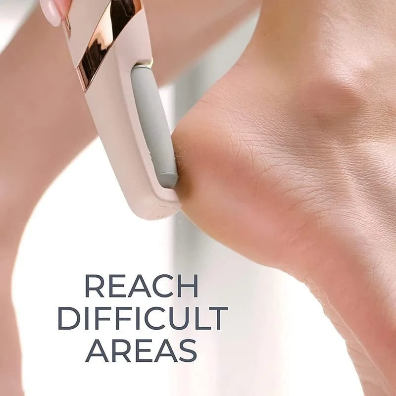 Solezia Electric Foot Callus Remover (Dead Skin Remover)