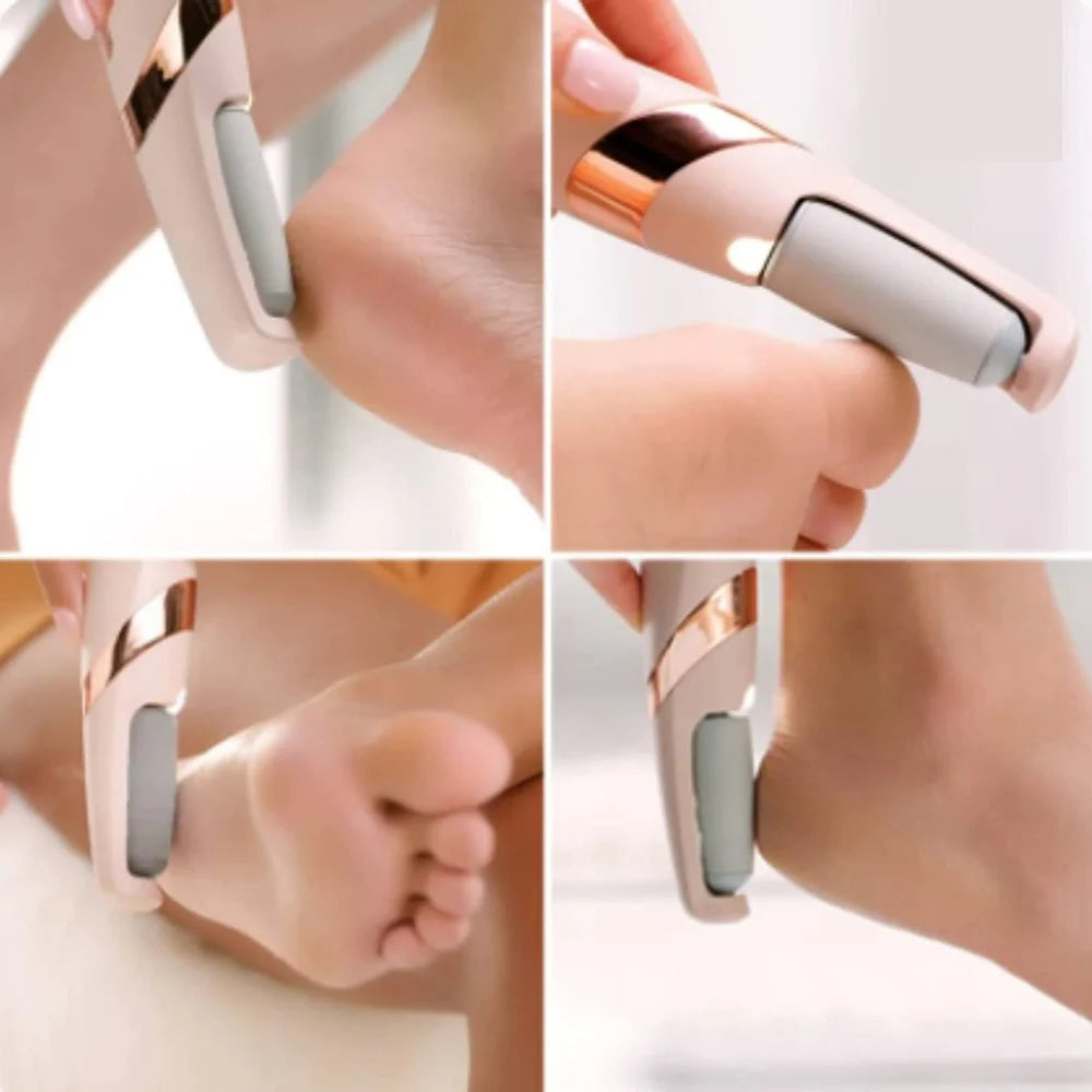 Solezia Electric Foot Callus Remover (Dead Skin Remover)