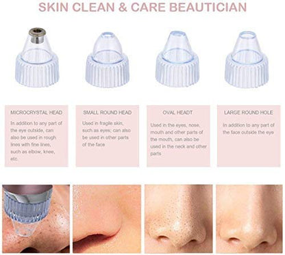 Derma Suction Blackhead Remover | Pimple Pore Cleaning Device