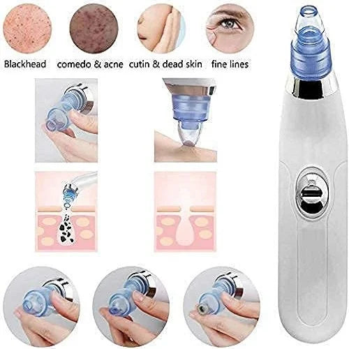 Derma Suction Blackhead Remover | Pimple Pore Cleaning Device